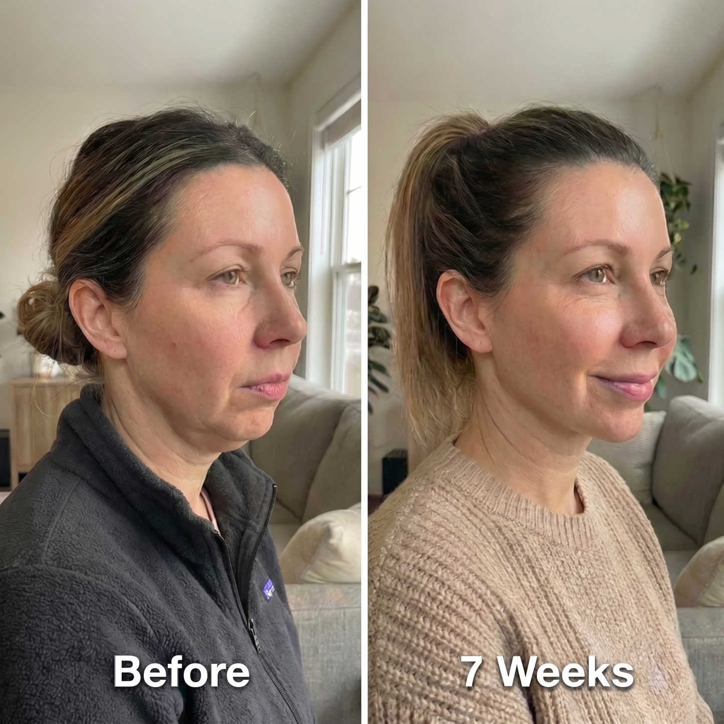 Jawline Slimming Face Wrap