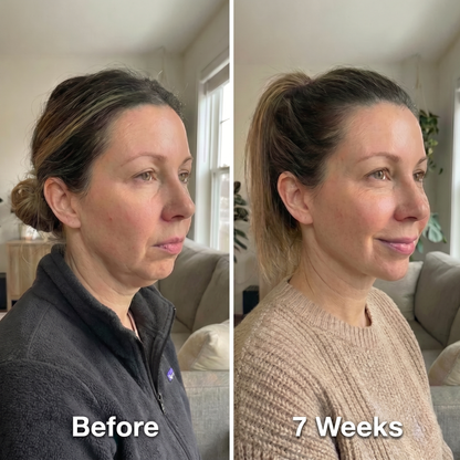 Jawline Slimming Face Wrap