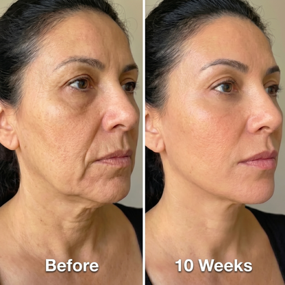 Jawline Slimming Face Wrap